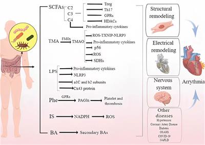 Gut microbiota and cardiac arrhythmia